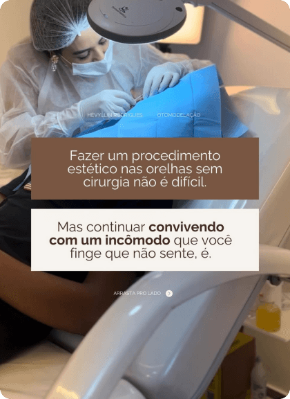Correção de Orelha de Abano Sem Cirurgia